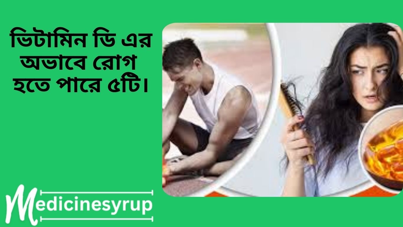 What diseases are caused by vitamin D deficiency? ভিটামিন ডি এর অভাবে রোগ হতে পারে ৫টি।