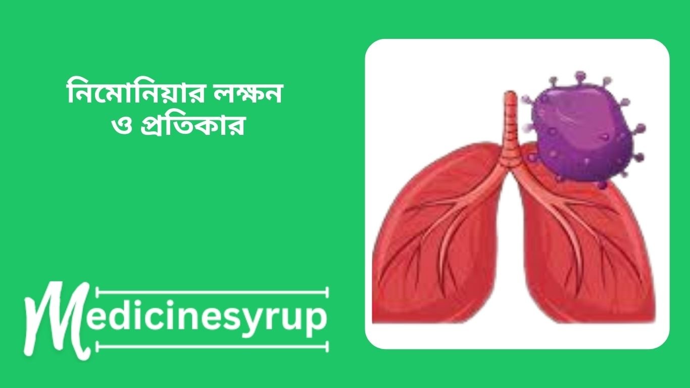 শিশুর নিউমোনিয়া রোগের লক্ষণ ও প্রতিকার