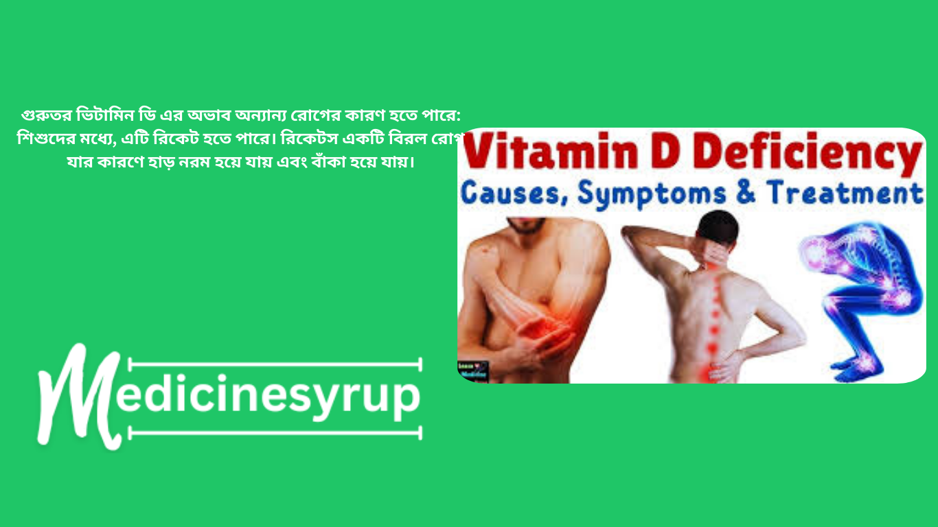 Diseases are caused by vitamin D deficiency? গুরুতর ভিটামিন ডি এর অভাব অন্যান্য রোগের কারণ হতে পারে: শিশুদের মধ্যে, এটি রিকেট হতে পারে। রিকেটস একটি বিরল রোগ যার কারণে হাড় নরম হয়ে যায় এবং বাঁকা হয়ে যায়।